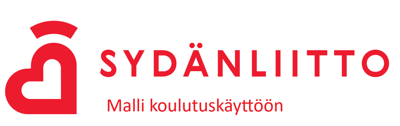 Yhdistys-malli
